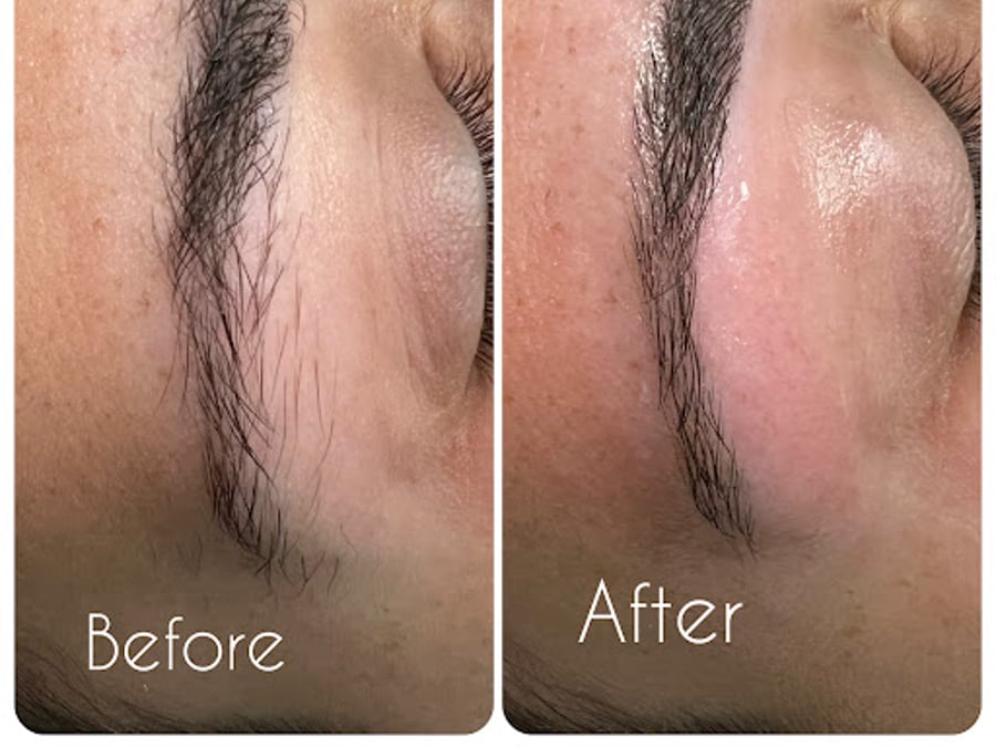 Derma Laser Center Inc