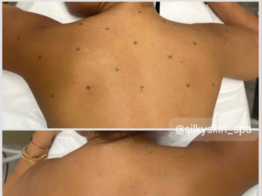 Silky Skin Spa