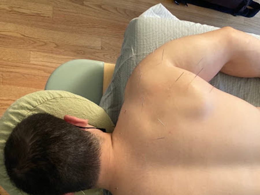 John Ditmars, LAc. - Integrative Acupuncture
