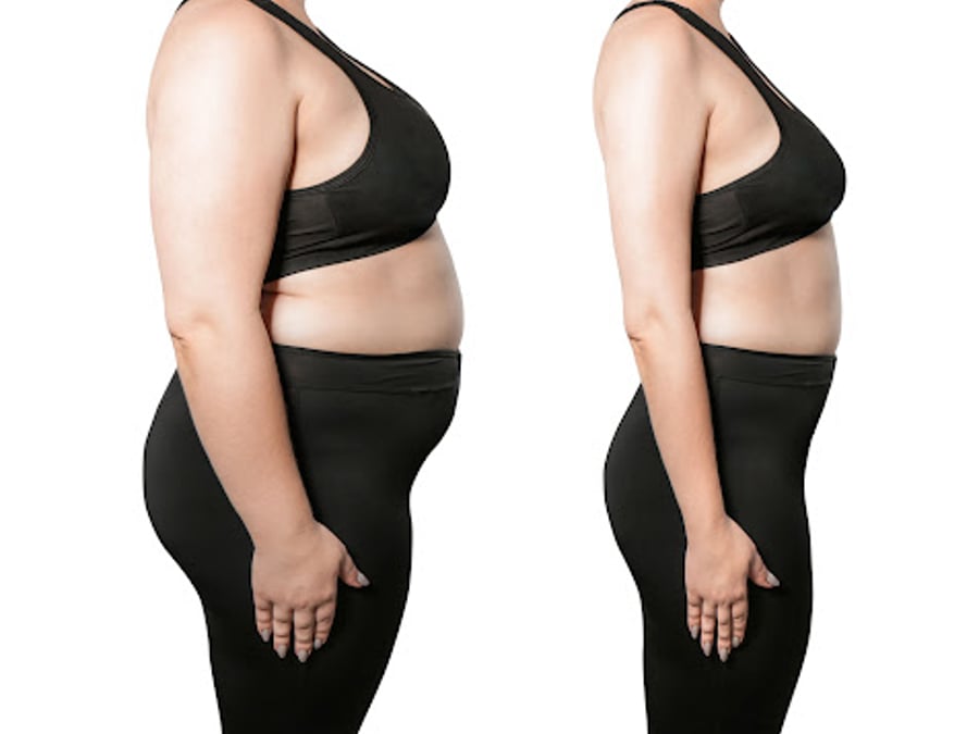 Slimmetry Medical Center