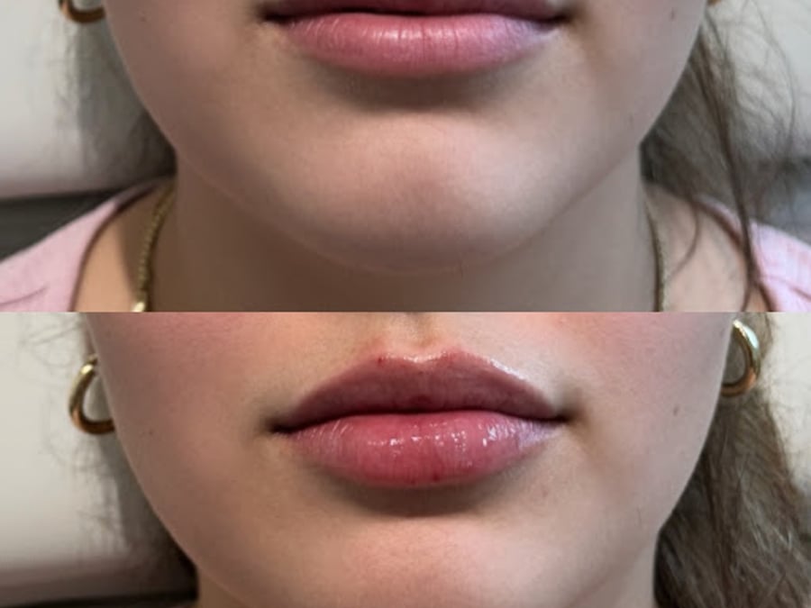 Add Beauty Med Spa | Huntington Beach