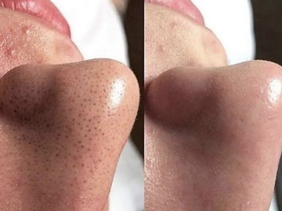 Superior Skin Aesthetics