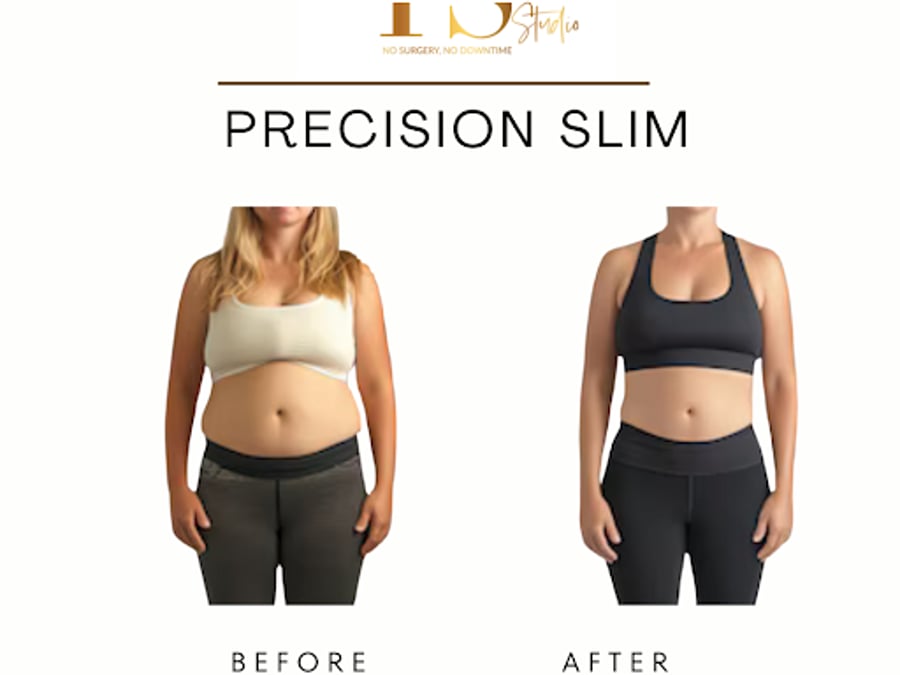 YOUR SCULPT STUDIO - Body & Face Contouring Experts
