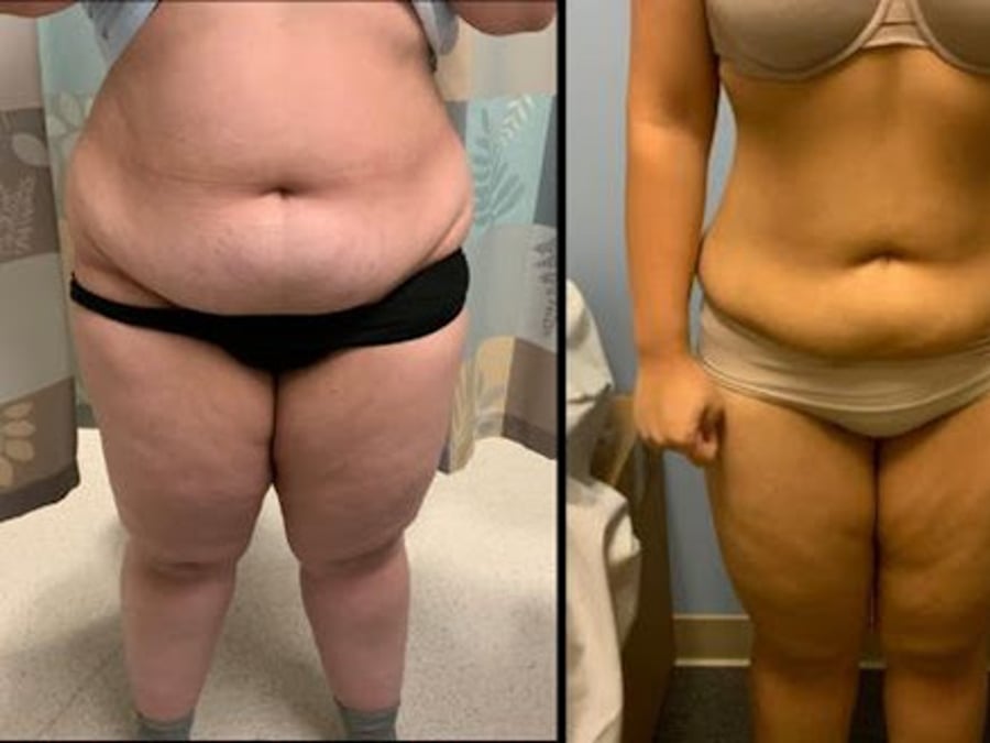 Allure Medical
