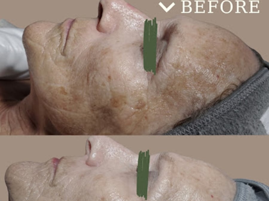 Solano Acne Clinic and Spa