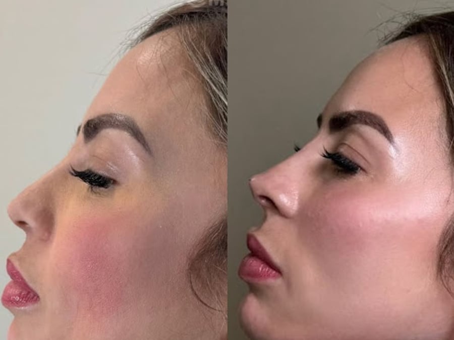 Jen's Beauty | PA Wellness PLLC Medspa
