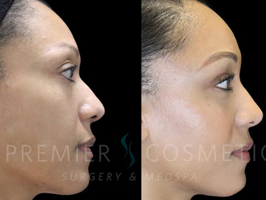 Premier Cosmetic Surgery & Med Spa