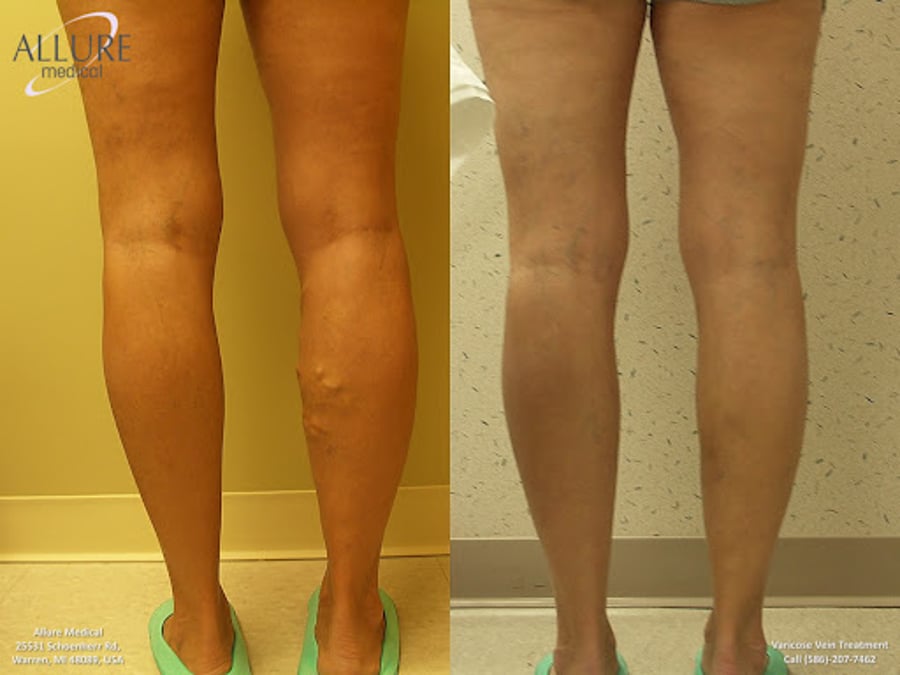 Allure Medical