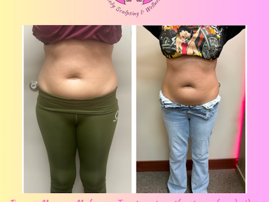 Powers Body Sculpting & Wellness