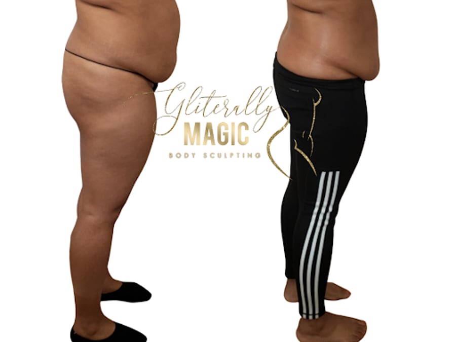 Gliterally Magic Body Sculpting