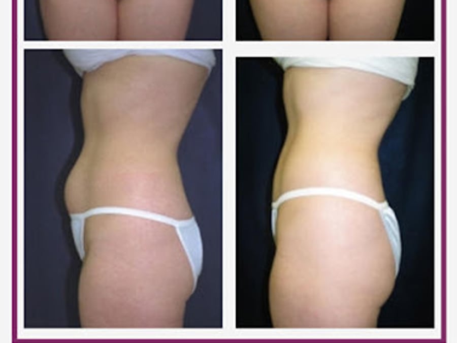 Nashua Plastic Surgery: George P. Chatson, M.D.