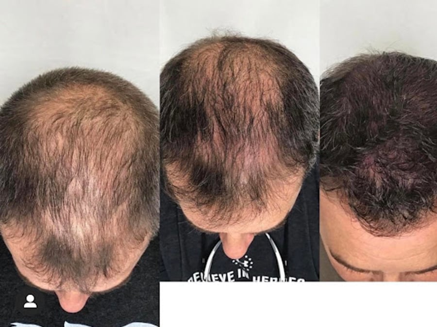 RNA Medical Aesthetics