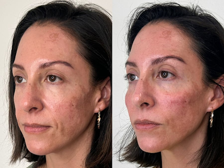 Nevé Aesthetics and Wellness