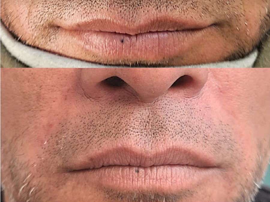 Medicis Medical Spa
