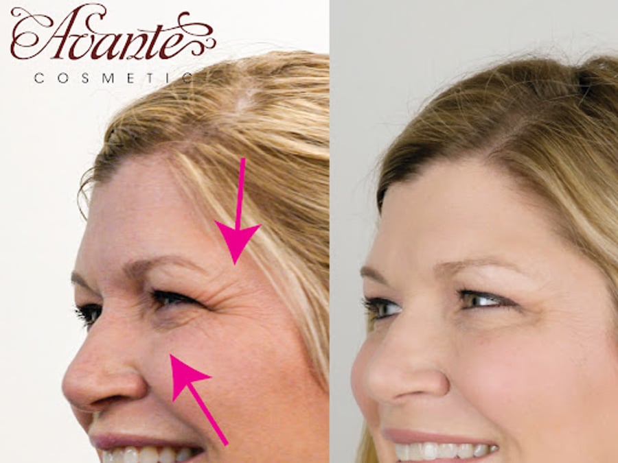 Avante Cosmetic