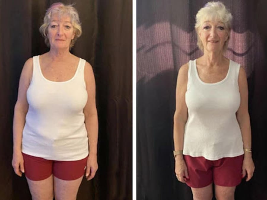 Sioux Falls Secret for Weight Loss