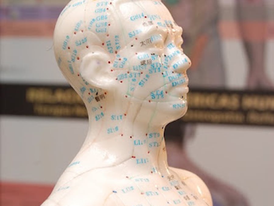 Acupuncture & Natural Therapies/ Melanie Myers