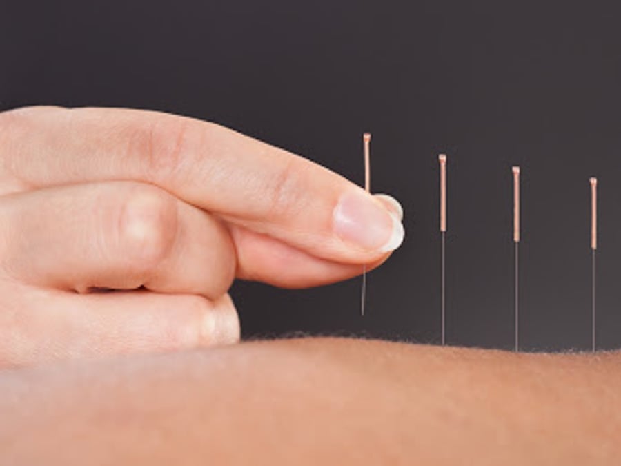 Access Acupuncture + Holistic Health
