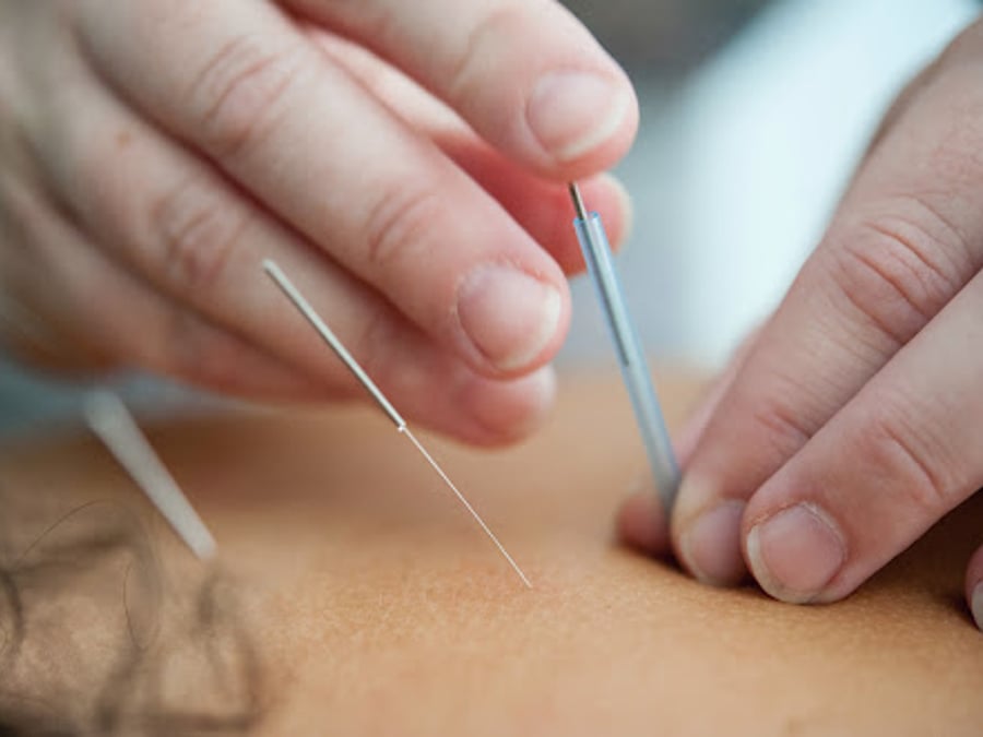 Daniel A. Wasserman, Acupuncture Physician