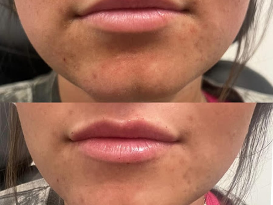 Simple Radiance Medical Spa