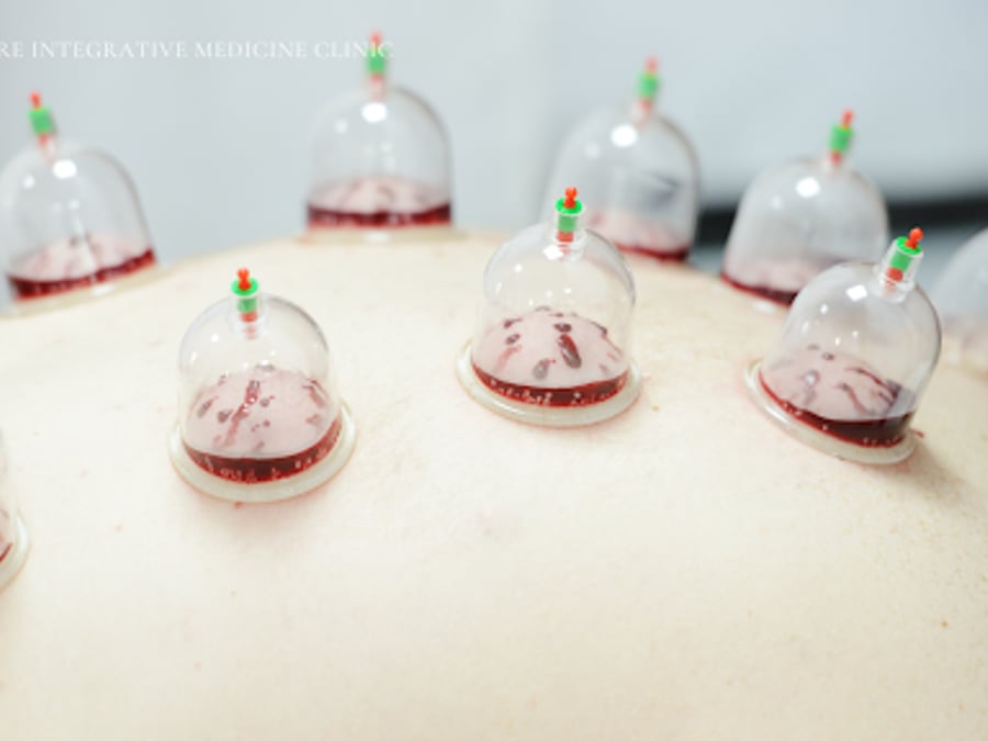 Bergen Acupuncture Integrative Medicine Clinic