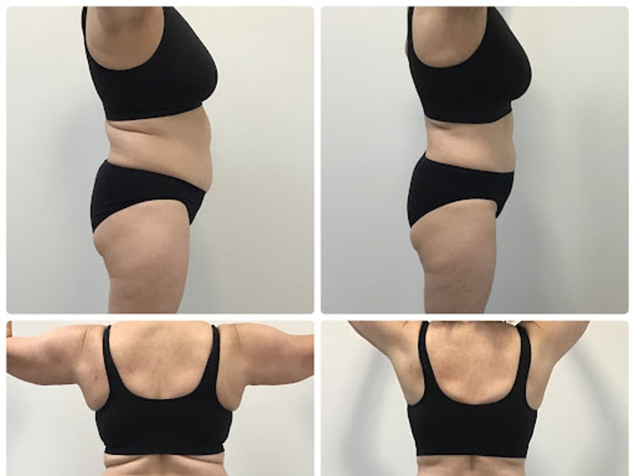 SDBotox - Killeen