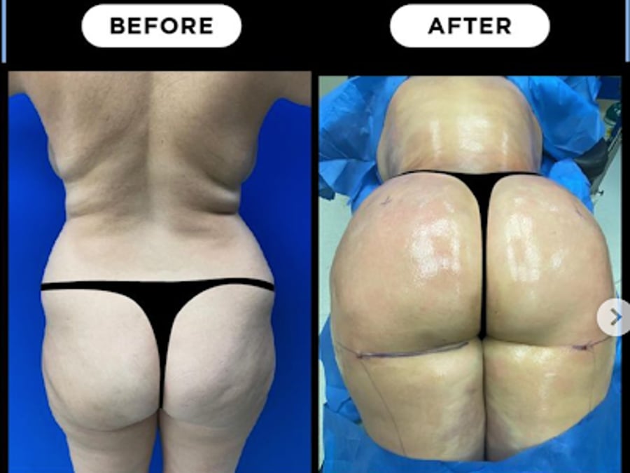 Advanced Body Sculpting of New England - Dr. Mark Lowney