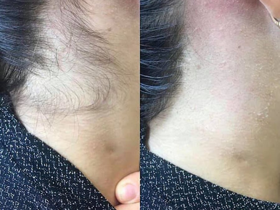 Palm Beach Laser & Aesthetic