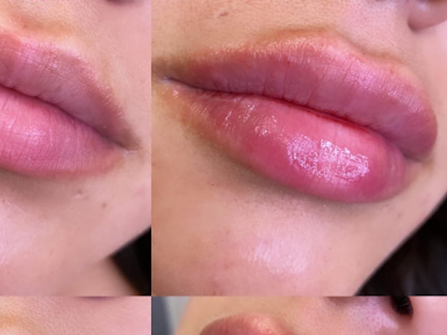 Lifted Beauty Med Spa