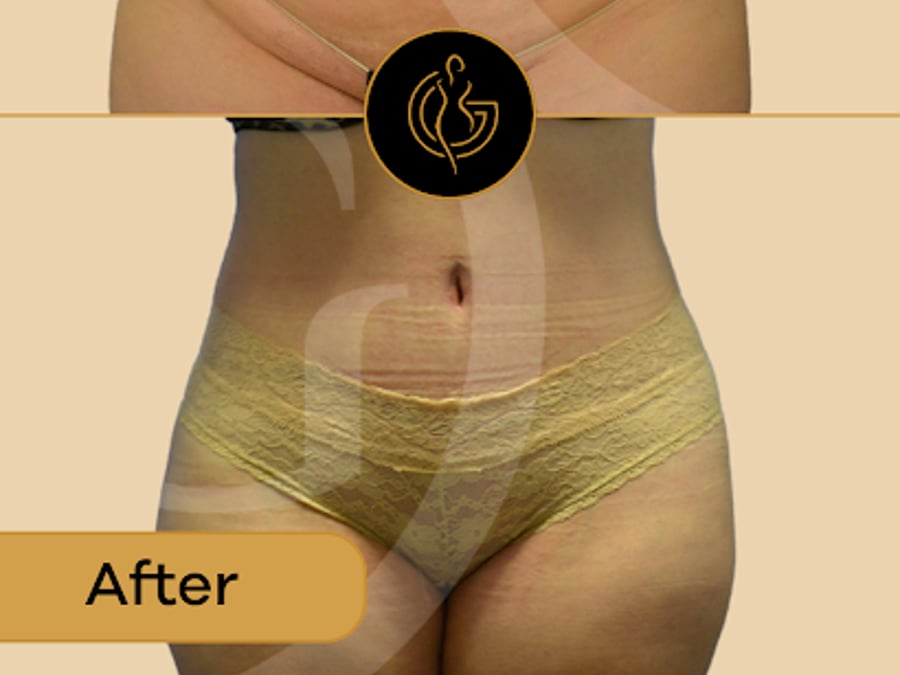 GLOW Surgical Arts