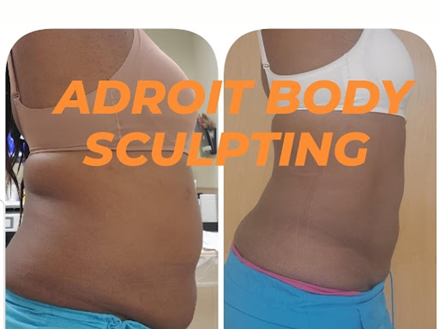 Adroit Body Sculpting