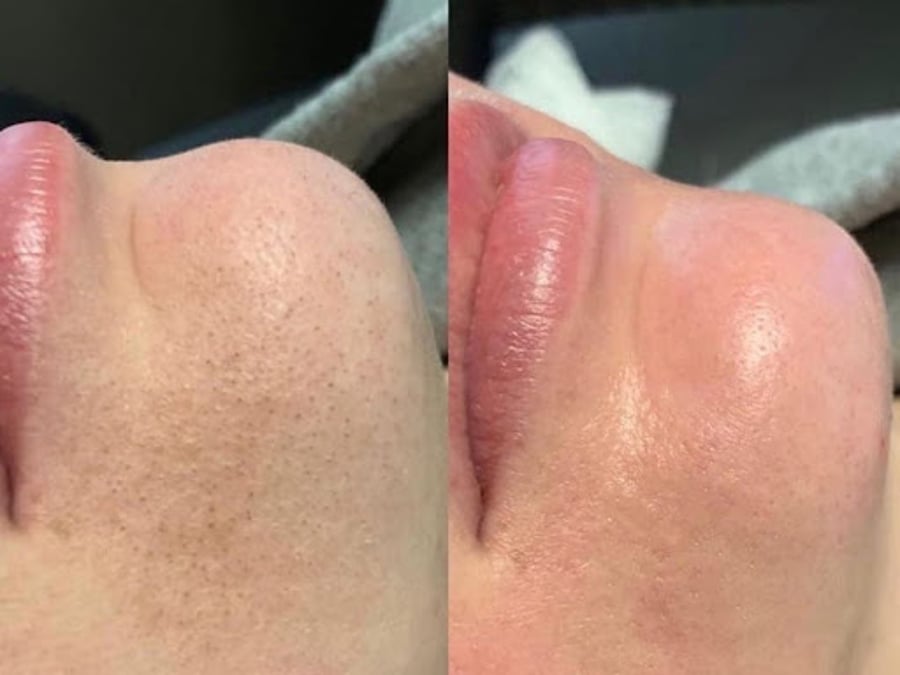 Skin Glow Medspa