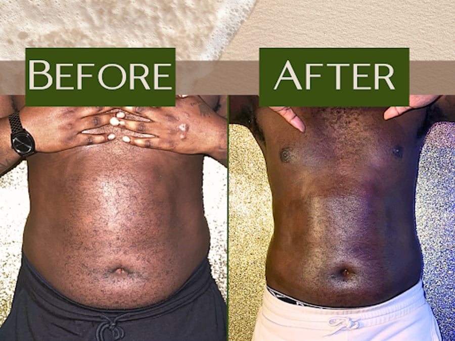 Siren Curves Body Sculpting