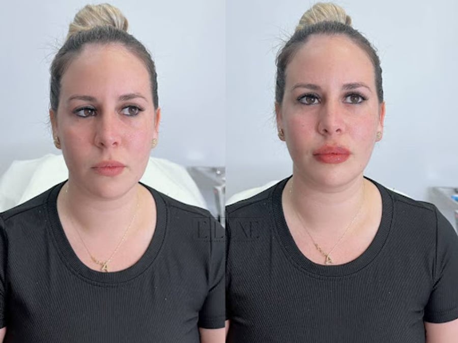 E-Luxe Aesthetics & Wellness