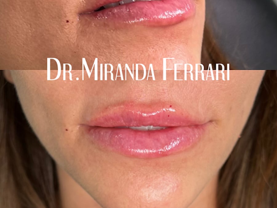 Ferrari Facial Aesthetics