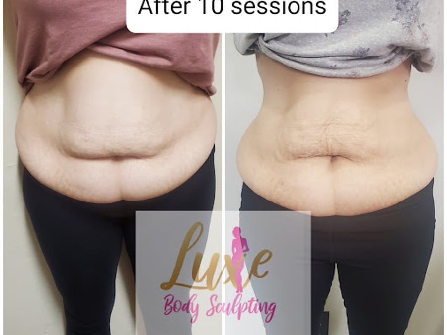 Luxe Body Sculpting