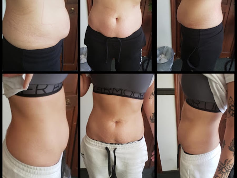 Dream Shape Body Contouring