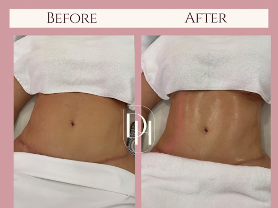 Dream Haus Sculpting Bar LLC