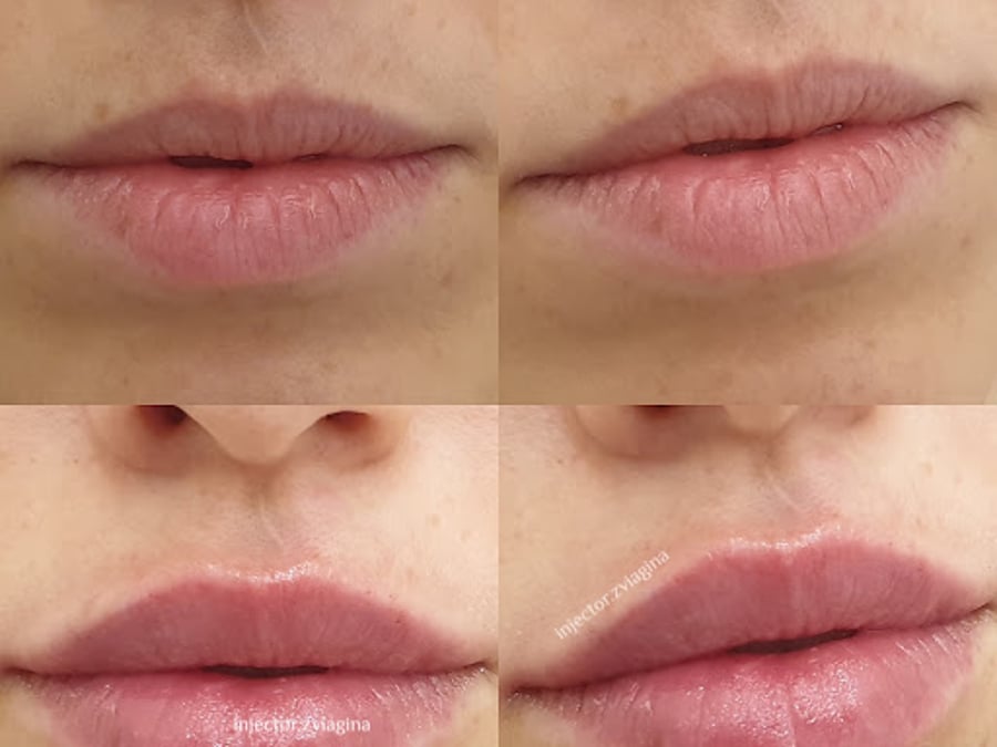 FACE LAB