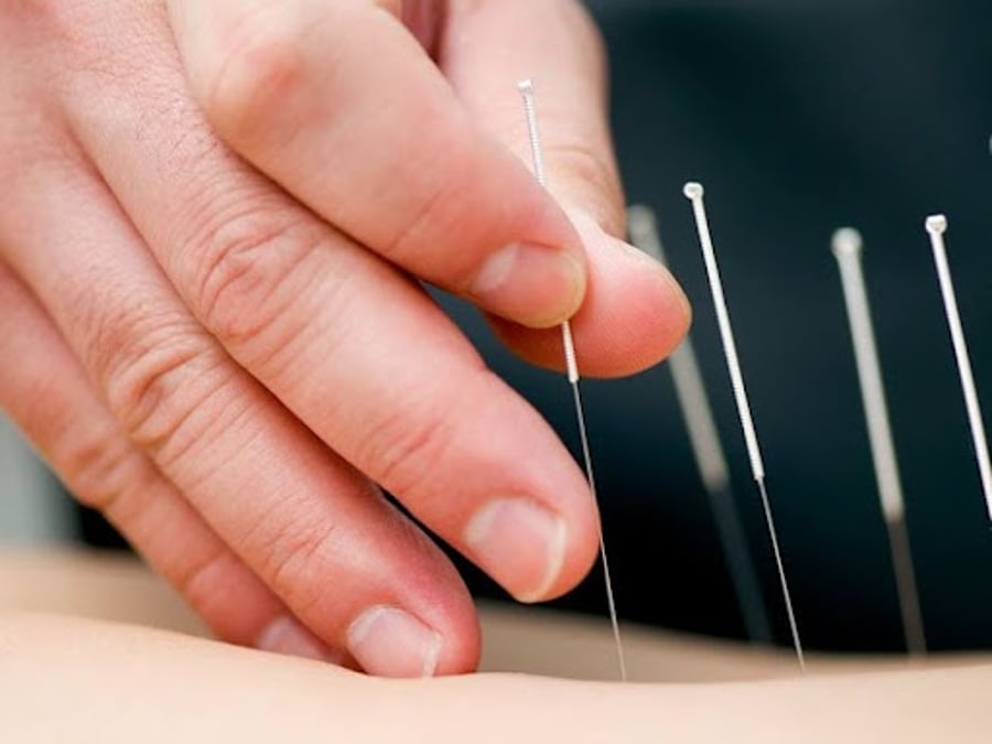 Avenzoar Acupuncture & Wellness Center