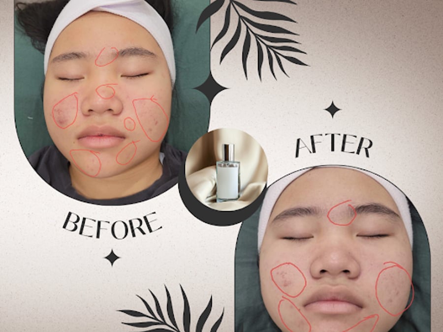 Catawba Natural Healing - Holistic Pain Specialist & Microneedling