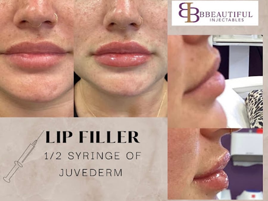 BBeautiful Injectables
