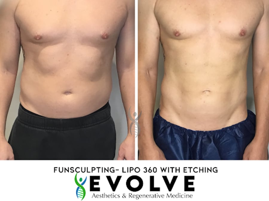 Evolve Aesthetics and Regenerative Medicine