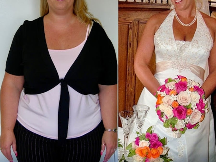 The Weight Loss Surgery Center of Los Angeles