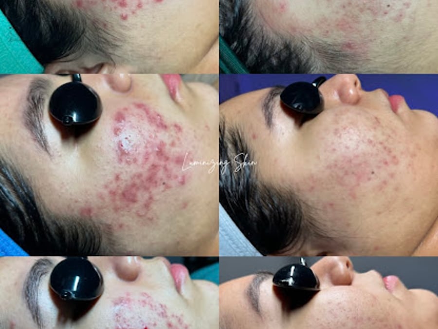 Luminizing Skin