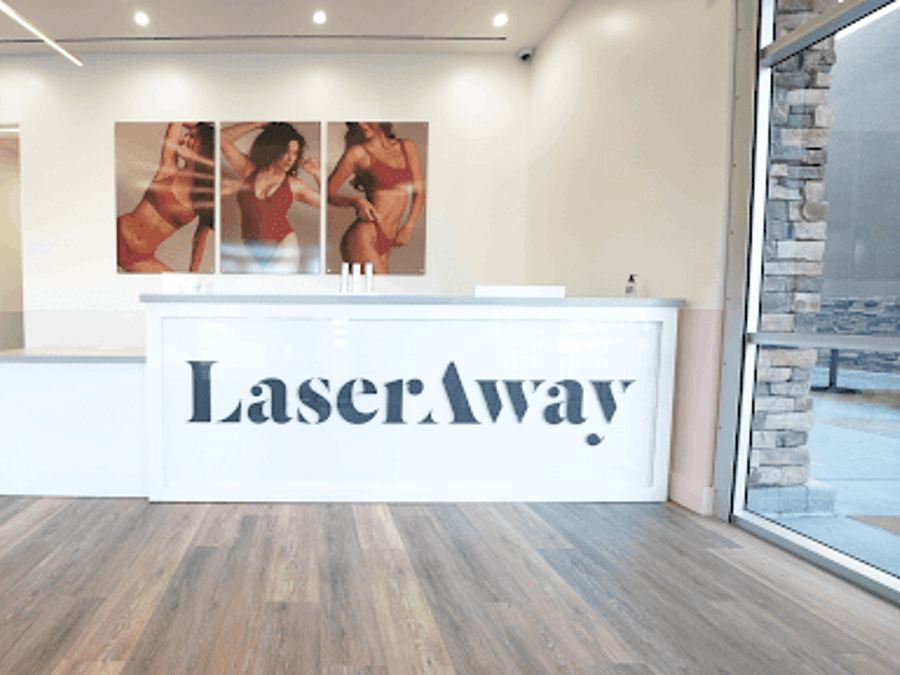 LaserAway Tracy