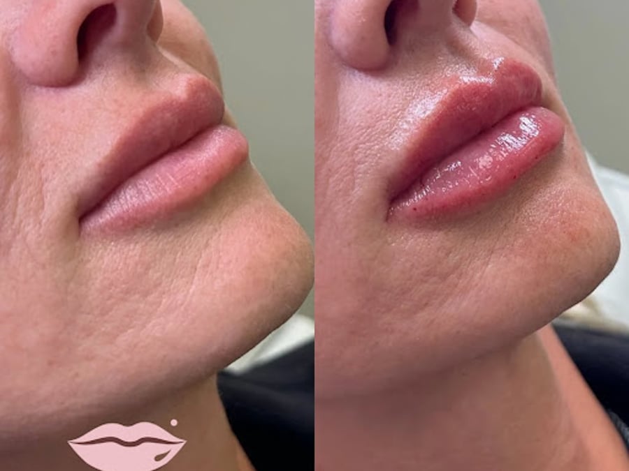 The Beauty Spot MedSpa