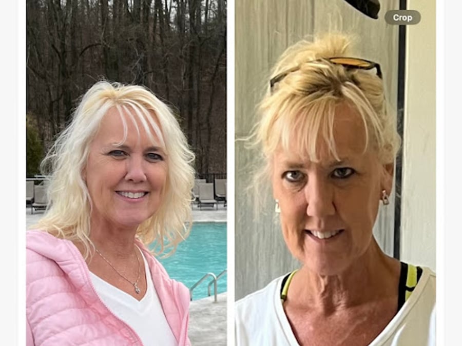 Bragg Weight Loss Chattanooga