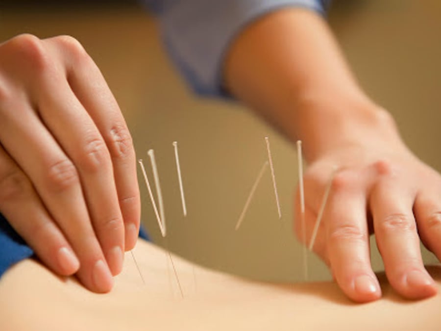 Acupuncture & Alternative Medicine of Staten Island