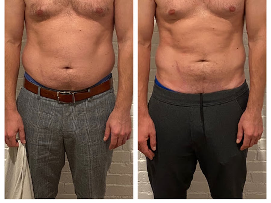 Vega Vitality MedSpa & Wellness - Back Bay Boston